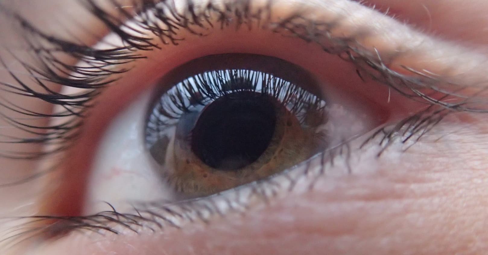 blindness and disability is SFF